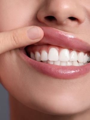 periodoncia valencia