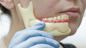 trastornos de la ATM