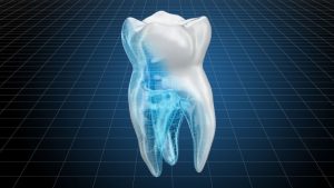 SENSIBILIDAD DENTAL